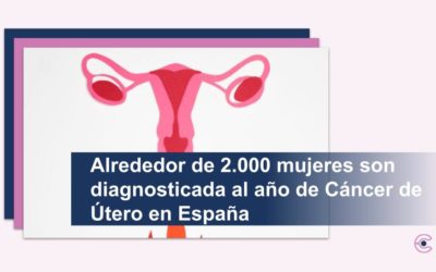 Alrededor de 2.000 mujeres son diagnosticada al año de Cáncer de Útero en España